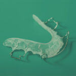 Ortopedia Funcional de los maxilares