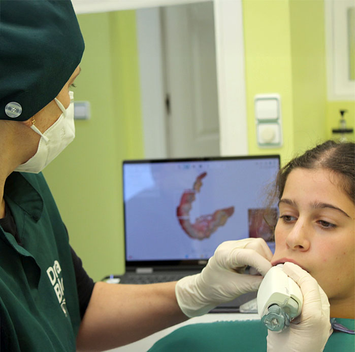 Scanner Intraoral - Dra.Blois