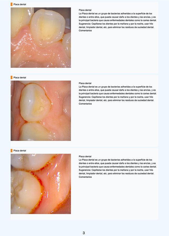 Imagen de placa bacteriana
